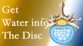 Old Mill Chiropractic uses spinal manipulation and exercise to boost the diffusion of water into the disc which helps the health of the disc.