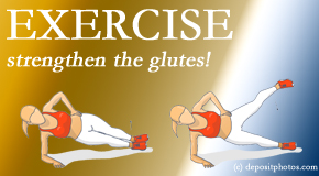 Old Mill Chiropractic determines which muscles – like the gluteus max and medius - are weak for back pain sufferers and which exercises best help strengthen them.