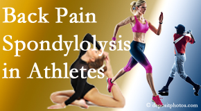 Old Mill Chiropractic treats athletes of all levels and all ages who have back pain using spinal manipulation, nutrition and specific exercise.