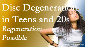 Old Mill Chiropractic relieves back pain due to disc degeneration in younger people in their teens and 20s.