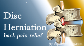 Old Mill Chiropractic offers non-surgical treatment for relief of disc herniation related back pain.