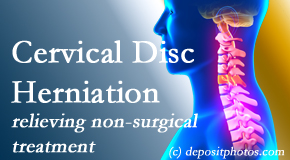 Old Mill Chiropractic offers the Cox® Technic spinal manipulation to treat cervical radiculopathy and avert surgery.