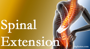 Old Mill Chiropractic knows the role of extension in spinal motion, its necessity, its benefits and potential harmful effects.