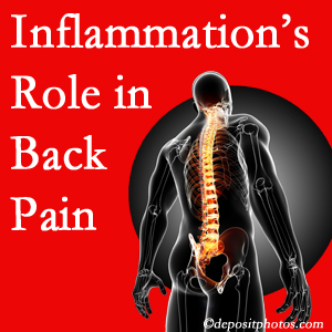 The role of inflammation in St Peters back pain is real. Chiropractic care can help.