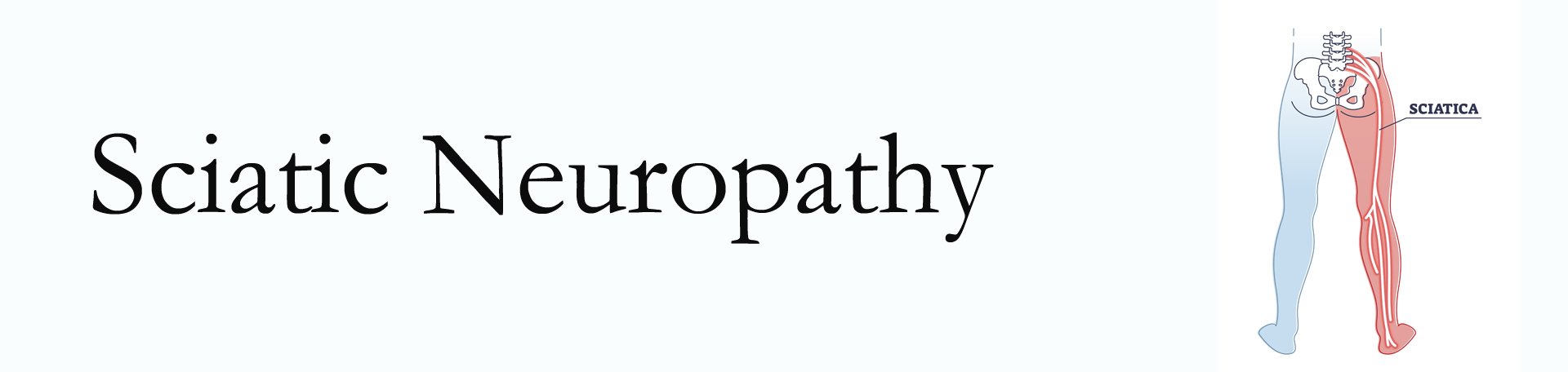 St Peters neuropathy pain (sciatica)