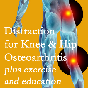 A chiropractic treatment plan for St Peters knee pain and hip pain caused by osteoarthritis: education, exercise, distraction.