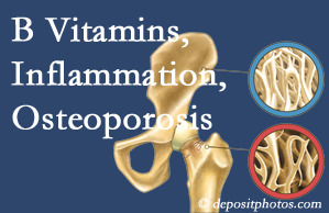 St Peters chiropractic care of osteoporosis usually comes with nutritional tips like b vitamins for inflammation reduction and for prevention.