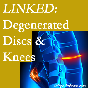 Degenerated discs and degenerated knees are not such strange bedfellows. They are seen to be related. St Peters patients with a loss of disc height due to disc degeneration often also have knee pain related to degeneration. 